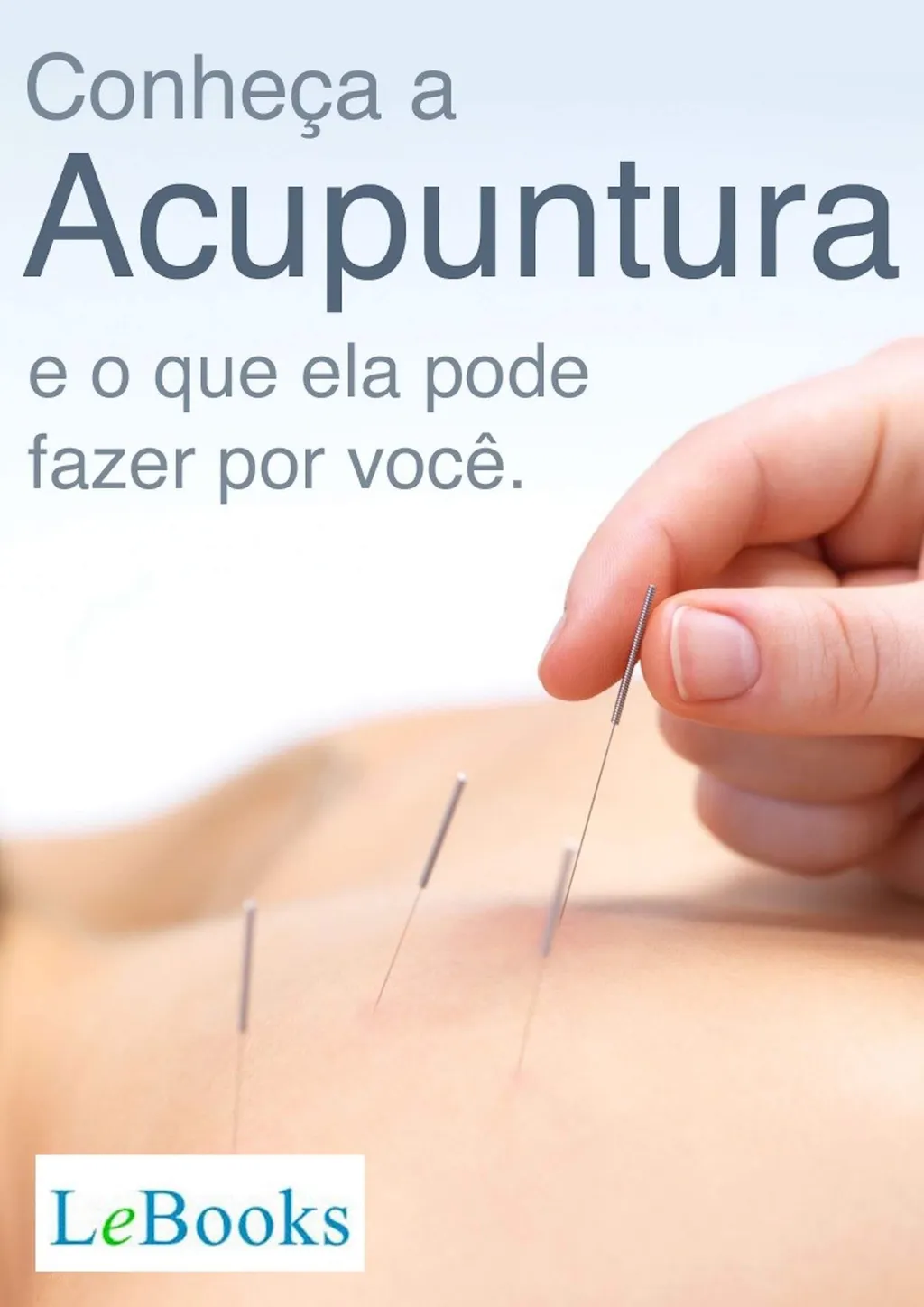 Conheça a acupuntura e o que ela pode fazer por você | Loja Skeelo